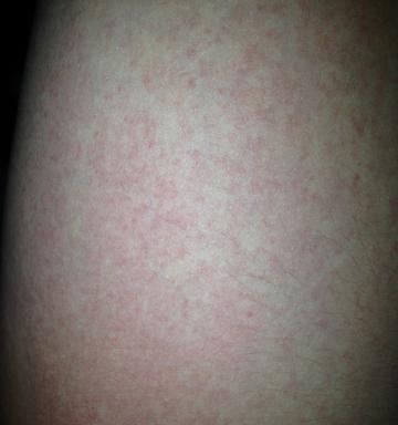 长时间不吃不喝引起的症状与危害（挑战极限）