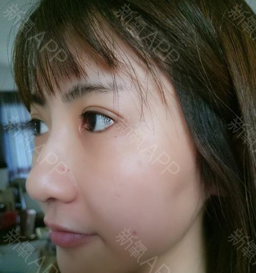 怀孕64天的症状及应对措施（了解怀孕初期的身体变化，做好孕期保健）