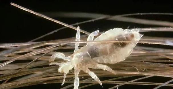 猫身上的虱子（解析猫身上的虱子及其生态习性）