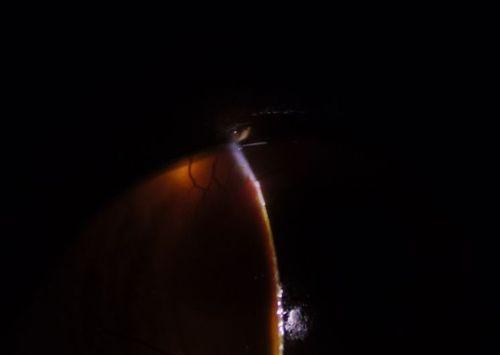 猫眼里的神秘黑黑之谜（解析猫眼中的黑色物质和其意义）