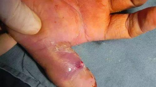 如何照顾截肢的狗狗（关爱与适应，让截肢宠物重拾幸福生活）