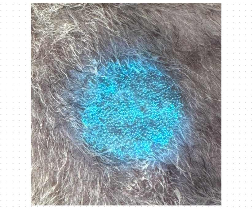 猫癣怎么诊断？