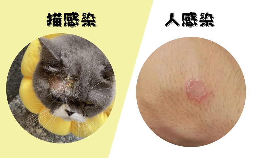 猫癣会不会传染人？