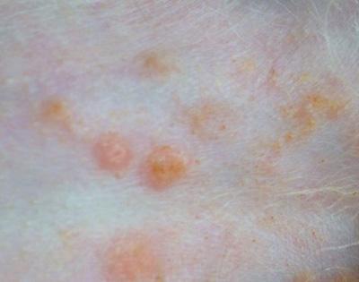 狗狗身上长脓包?千万别到皮肤严重溃烂才重视