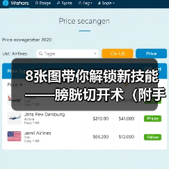 8张图带你解锁新技能——膀胱切开术（附手术视频）