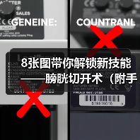 8张图带你解锁新技能——膀胱切开术（附手术视频）